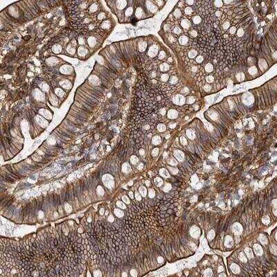 Immunohistochemistry-Paraffin: AHNAK Antibody [NBP1-81058]