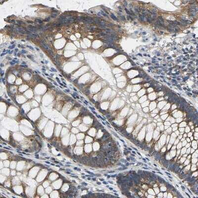 Immunohistochemistry-Paraffin: AHNAK Antibody [NBP1-81059]