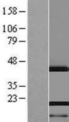 Western Blot: AHNAK Overexpression Lysate [NBP2-06357]