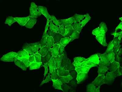 Immunocytochemistry/ Immunofluorescence: AHNAK2 Antibody [NBP2-98657]