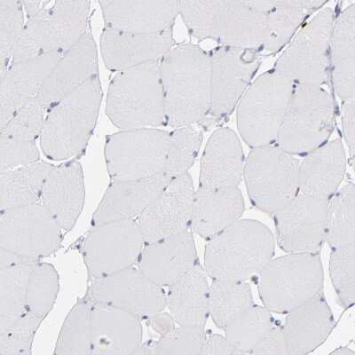 Immunohistochemistry-Paraffin: AHNAK2 Antibody [NBP1-88428]