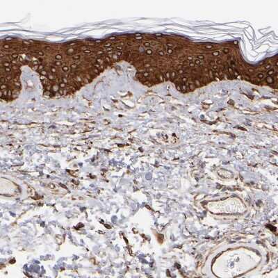 Immunohistochemistry-Paraffin: AHNAK2 Antibody [NBP1-88428]