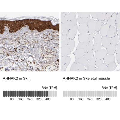 Immunohistochemistry-Paraffin: AHNAK2 Antibody [NBP1-88428]