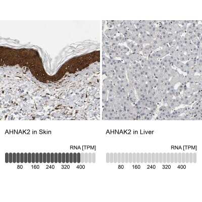 Immunohistochemistry-Paraffin: AHNAK2 Antibody [NBP1-88429]