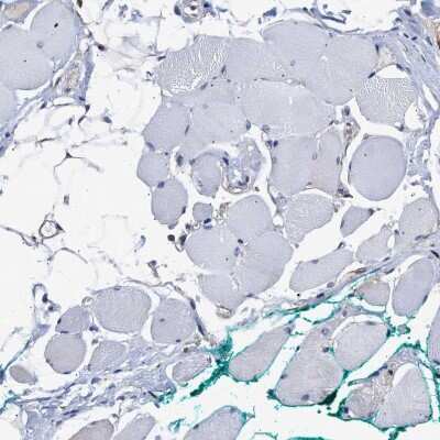 Immunohistochemistry-Paraffin: AHNAK2 Antibody [NBP2-47554]