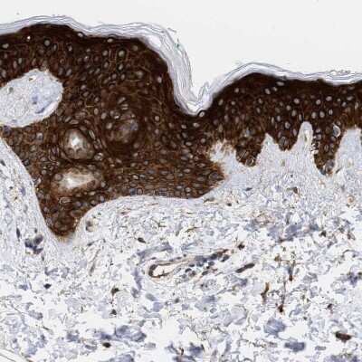Immunohistochemistry-Paraffin: AHNAK2 Antibody [NBP2-47554]