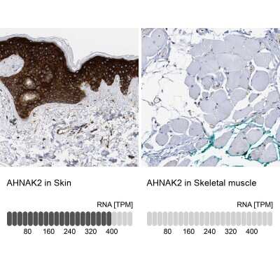 Immunohistochemistry-Paraffin: AHNAK2 Antibody [NBP2-47554]