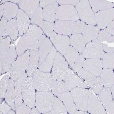 Immunohistochemistry-Paraffin: AHNAK2 Antibody [NBP2-48488]