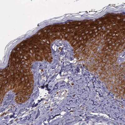 Immunohistochemistry-Paraffin: AHNAK2 Antibody [NBP2-48488]