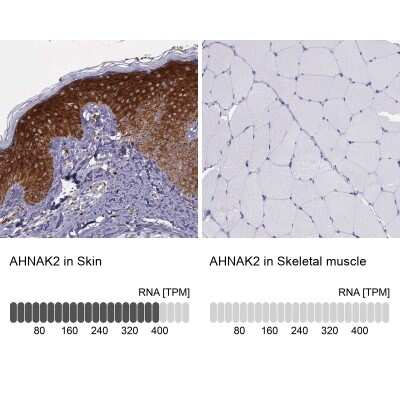 Immunohistochemistry-Paraffin: AHNAK2 Antibody [NBP2-48488]