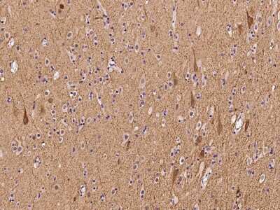 Immunohistochemistry-Paraffin: AHNAK2 Antibody [NBP2-98657]