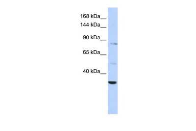 Western Blot: AHNAK2 Antibody [NBP1-57661]