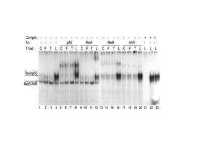 Gel Super Shift Assays: AHR Antibody [NB100-128]