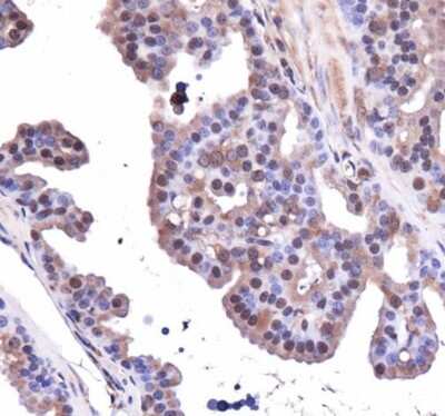 Immunohistochemistry: AHR Antibody - BSA Free [NB100-2289]