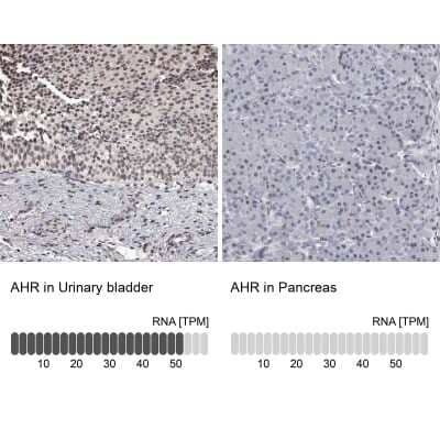 Immunohistochemistry-Paraffin: AHR Antibody [NBP1-89975]