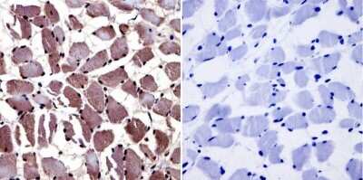 Immunohistochemistry-Paraffin: AHR Antibody (RPT1) [NB300-530]