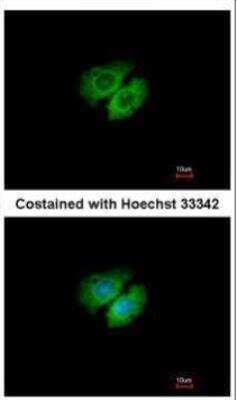 Immunocytochemistry/ Immunofluorescence: AHSA1 Antibody [NBP1-33298]