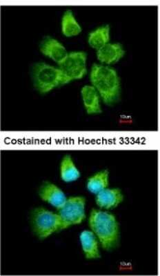 Immunocytochemistry/ Immunofluorescence: AHSA1 Antibody [NBP2-15311]