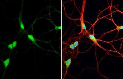 Immunocytochemistry/ Immunofluorescence: AHSA1 Antibody [NBP2-15311]