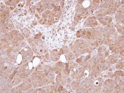 Immunohistochemistry-Paraffin: AHSA1 Antibody [NBP1-33298]
