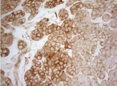 Immunohistochemistry: AHSA1 Antibody (OTI1D2) - Azide and BSA Free [NBP2-71608]