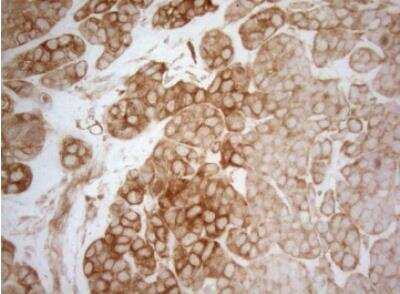 Immunohistochemistry-Paraffin: AHSA1 Antibody (OTI1D2) [NBP2-46503]