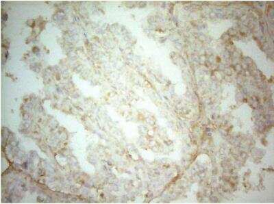 Immunohistochemistry-Paraffin: AHSA1 Antibody (OTI1D2) [NBP2-46503]
