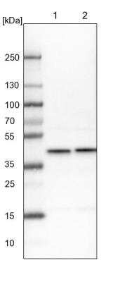 Western Blot: AHSA1 Antibody [NBP1-88419]