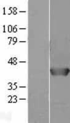 Western Blot: AHSA1 Overexpression Lysate [NBL1-07404]