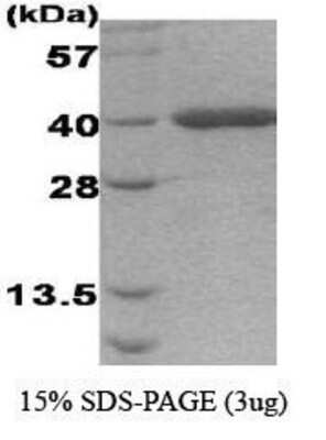 SDS-PAGE: Recombinant Human AHSA1 Protein [NBC1-18368]