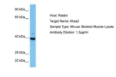 Western Blot: AHSA2 Antibody [NBP2-84410]