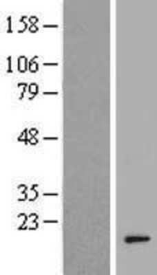 Western Blot: AHSA2 Overexpression Lysate [NBP2-05375]