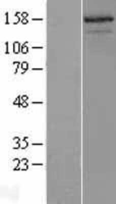 Western Blot: NCOA3/AIB1 Overexpression Lysate [NBL1-13517]