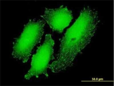 Immunocytochemistry/ Immunofluorescence: AIBZIP Antibody (3E3) [H00148327-M01]
