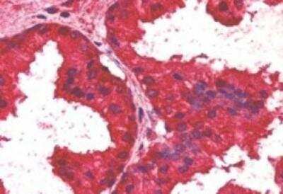 Immunohistochemistry-Paraffin: AIBZIP Antibody [NB100-1015]