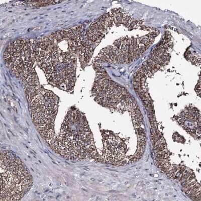 Immunohistochemistry-Paraffin: AIBZIP Antibody [NBP1-90205]