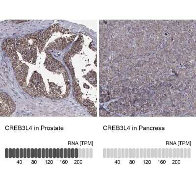 Immunohistochemistry-Paraffin: AIBZIP Antibody [NBP1-90205]