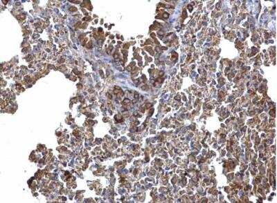 Immunohistochemistry-Paraffin: AICDA Antibody [NBP1-30955]