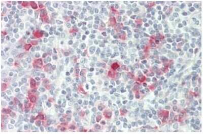 Immunohistochemistry-Paraffin: AICDA Antibody [NBP3-10976]