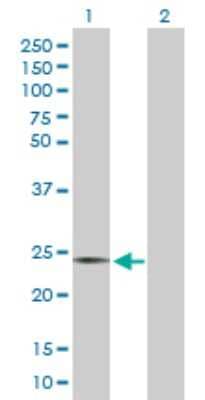 Western Blot: AICDA Antibody [H00057379-D01P]