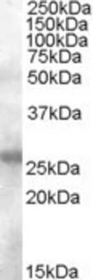 Western Blot: AICDA Antibody [NB100-93454]