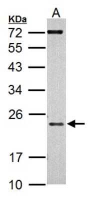 Western Blot: AICDA Antibody [NBP1-30955]