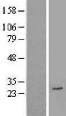 Western Blot: AICDA Overexpression Lysate [NBL1-07406]