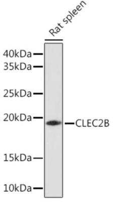 Western Blot: AICL/CLEC-2B AntibodyAzide and BSA Free [NBP2-92358]