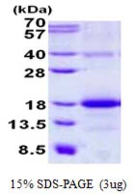 SDS-PAGE: Recombinant Human AICL/CLEC-2B His Protein [NBP2-22965]