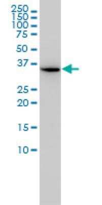 Western Blot: AIDA Antibody (2E6-1C11) [H00064853-M01]