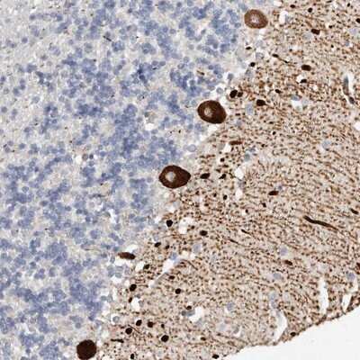 Immunohistochemistry-Paraffin: AIDA Antibody [NBP1-88323]