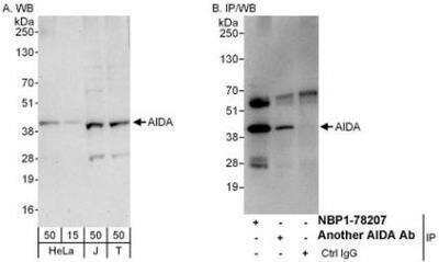 Western Blot: AIDA Antibody [NBP1-78207]