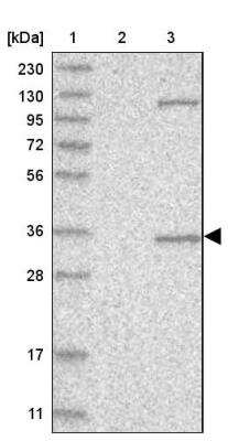 Western Blot: AIDA Antibody [NBP1-88323]