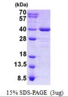 SDS-PAGE: Recombinant Human AIDA His Protein [NBP2-22703]